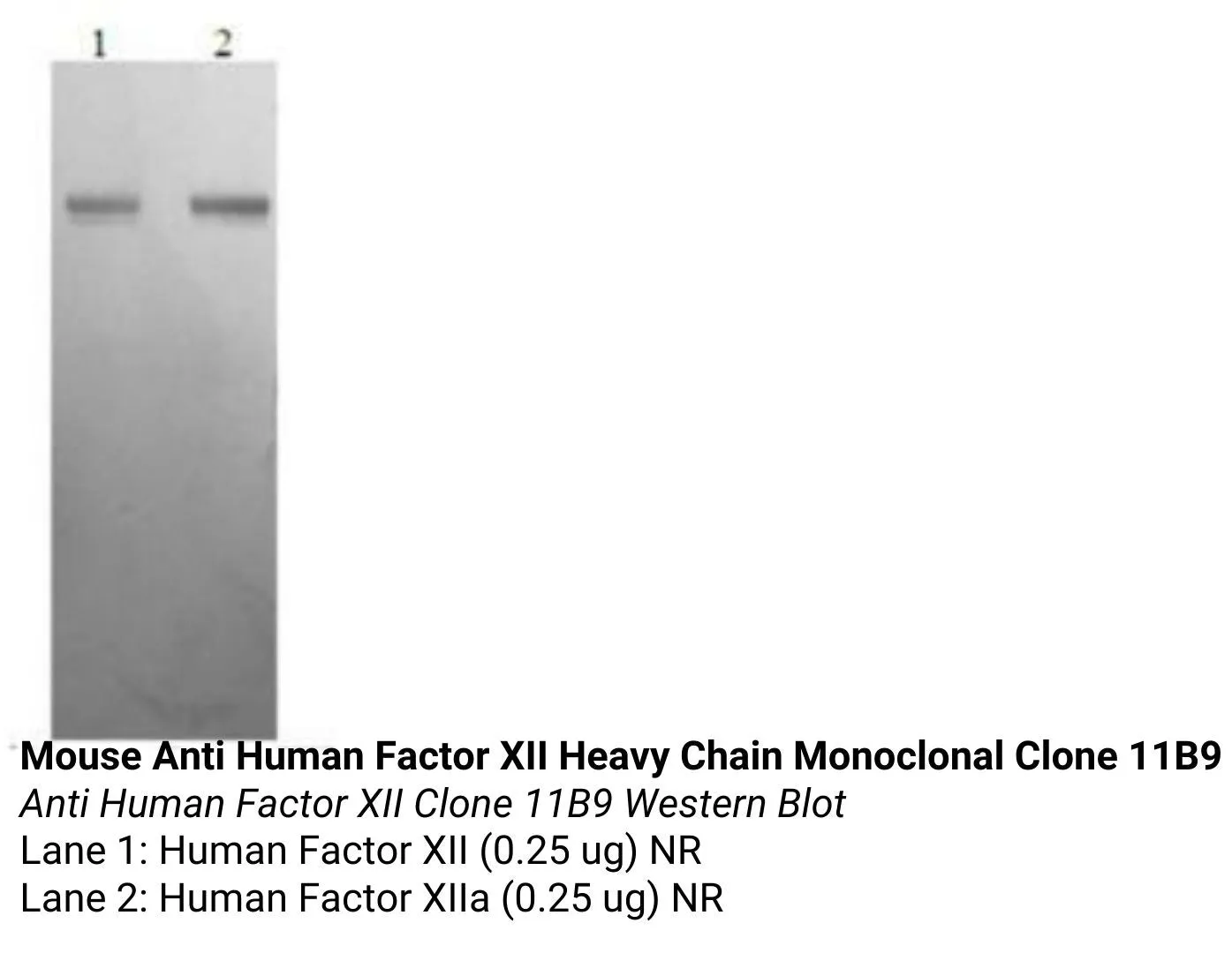 *Mouse Anti Human Factor XII Heavy Chain Monoclonal Clone 11B9